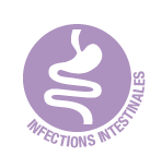 Soulager les infections intestinales  (gastro-entérite, turista, diarrhée) avec les huiles essentielles
La gastro-entérite est  une inflammation de la muqueuse du tube digestif (estomac, intestin grêle et colon), causée le plus souvent par un virus (rotavirus, antérovirus...), et parfois par une bactérie (salmonelle, E.coli...) ou un parasite (giardias).
Les symptômes 
Cette inflammation est responsable de diarrhées aigües pouvant s'accompagner de nausées, de vomissements, de douleurs abdominales (crampes), d'une fièvre modérée et de fatigue. La gastro-entérite se transmet par contact direct ou indirect (objet souillé) entre une personne et un malade ou par ingestion d'aliments contaminés ou de l'eau souillée. Les vomissements durent en général un à trois jours mais la diarrhée peut persister une à deux semaines.
La gastro-entérite peut entraîner des complications comme la déshydratation, surtout chez les jeunes enfants, les personnes âgées ou les sujets ayant une pathologie chronique.
Soulager la gastro-entérite avec les huiles essentielles
Le traitement est généralement symptomatique (anti-diarrhéiques,  solutions de réhydratation orale...) et la prévention repose sur des mesures d'hygiène : lavage fréquent des mains, désinfection des toilettes, aliments au frais et non périmés, eau en bouteilles dans les pays à risques (pour prévenir la "turista").
L’huile essentielle de Cannelle écorce est une puissante anti-infectieuse, très efficace pour rétablir l’équilibre du système digestif et neutraliser l’infection.
Attention : l’huile essentielle de Cannelle est dermocaustique, il ne faut donc pas la mettre en contact direct avec la muqueuse buccale mais l’avaler dans une gélule ou bien dans de la mie de pain.
Gastro et infections intestinales